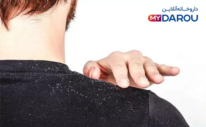 مای دارو - بهترین شامپو برای شوره و خارش سر و التهاب